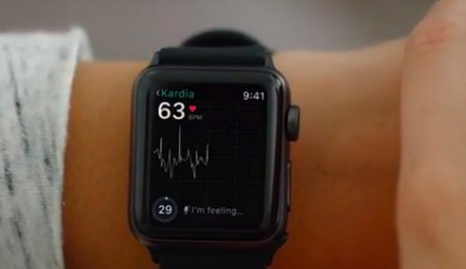 心電図がとれるApple Watch用医療アクセサリー「KardiaBand」が発表！